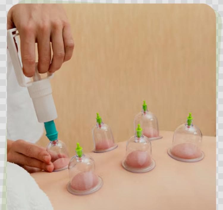 Séance de Hijama, thérapie par les ventouses